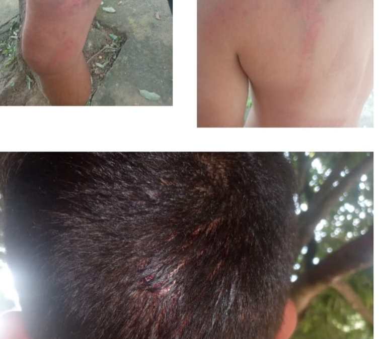 Por secuestro y tortura de manifestantes, denuncian a policías en Barrancabermeja
